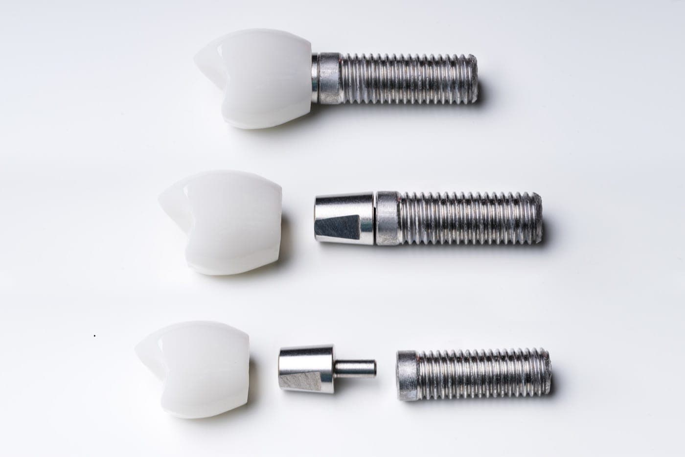 Dental implant components: titanium screw, abutment connector, and porcelain crown