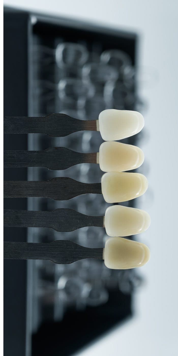 Turkey Teeth Explained: Veneers, Crowns and Real Costs (2026)