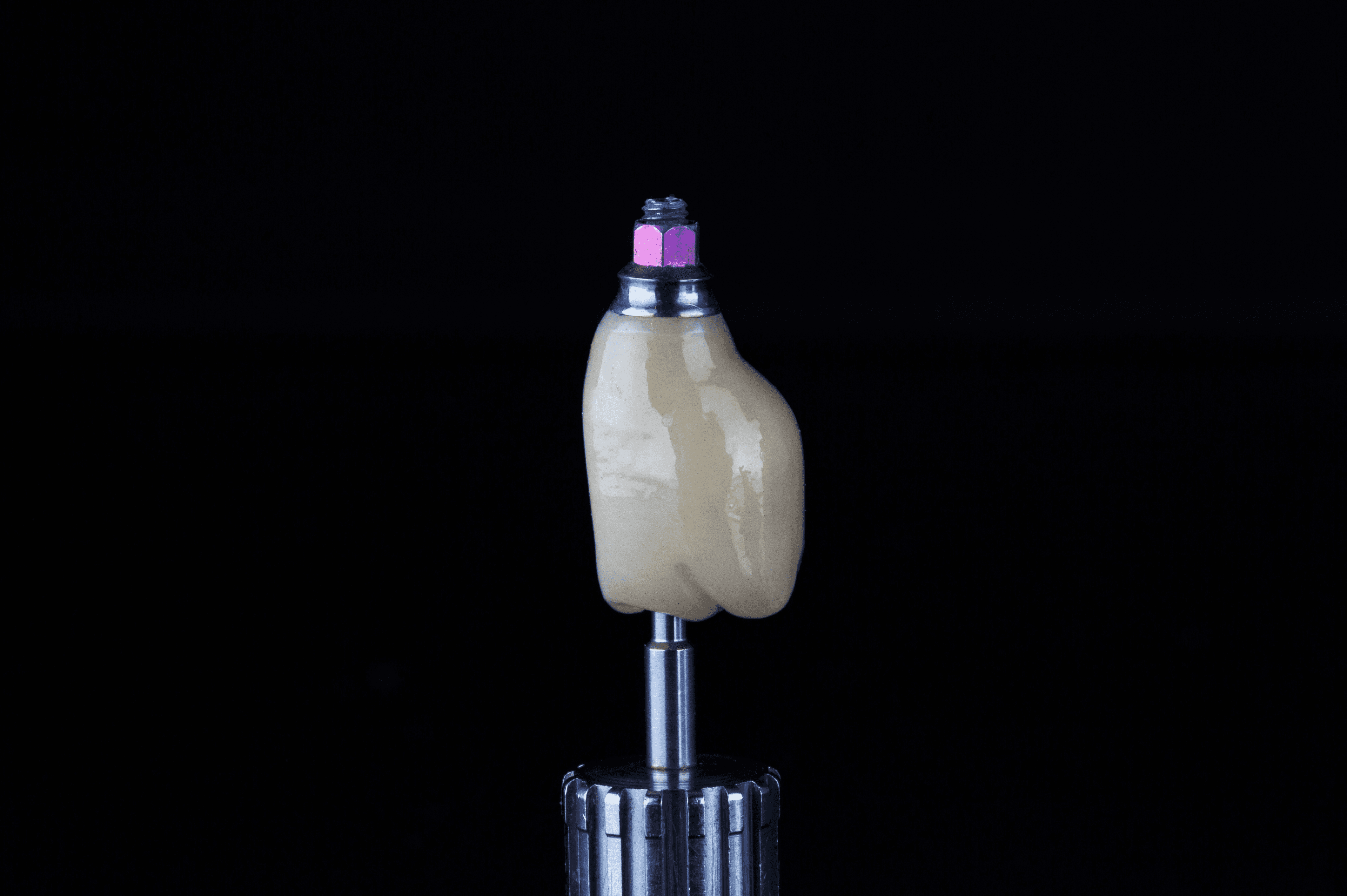 İmplant Çeşitleri ve Markaları: Hangisi Size Uygun?